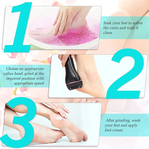 Electric Foot Callus Remover